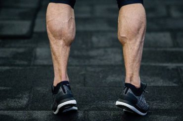 calves