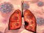 exercises for healthy lungs