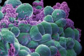 Study Reveals: Eliminating Extra Chromosomes in Cancer Cells Shows Promise in Preventing Tumour Growth