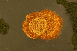 New Discovery: Immune Cells Found to Play Key Role in Brain Waste Clearance