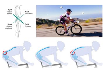 Muscle Asymmetry