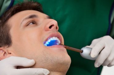 Dental Hygiene Linked to Lower Risk of Head and Neck Cancer: New Research Findings