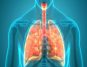 A New Study Reveals How Phlegm Color Predicts Lung Disease Outcomes