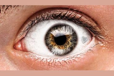 Study Shows Eye Implant as a Potential Breakthrough in Diabetes Treatment