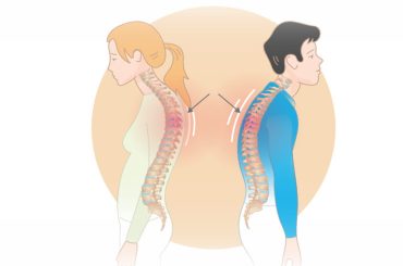 Is that Hump on Your Neck Text Neck? Learn How to Correct It