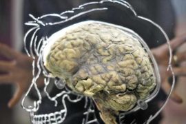 Hunger Hormones Unveiled: Study Reveals How They Impact Decision-Making Brain Areas and Drive Behavior