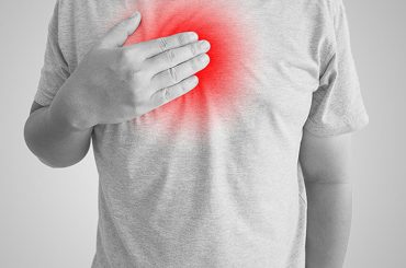 Ease the Burn: Effective Strategies for Managing Heartburn