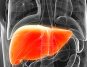 Understanding Fatty Liver Disease: Unveiling Causes and Expert Tips to Combat this Silent Disease