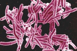 Experts Develop Immune-Enhancing TB Therapies: Study