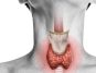 Top Foods for Combatting Thyroid Issues: Your Ultimate Guide