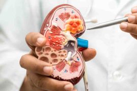 Plastic Usage and Kidney Health: Insights from Doctors