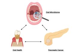 Poor Oral Hygiene: Uncovering its Link to Increased Pancreatic Cancer Risks