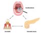 Poor Oral Hygiene: Uncovering its Link to Increased Pancreatic Cancer Risks