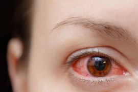 Tips for Shielding Your Eyes from Seasonal Infections