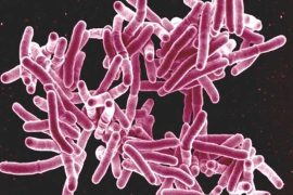 strains of tuberculosis