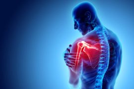 Understanding Shoulder Arthritis: Symptoms, Treatments, and Advances in Replacement Surgery