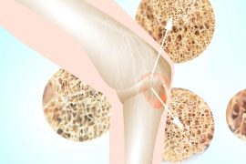 Top Ayurvedic Remedies to Strengthen and Support Bone Health Naturally
