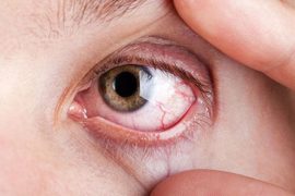 Too Much Screen Time? Eat & Live Right for Healthy Eyes!