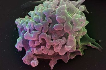New Research Identifies Rare Immune Cells Crucial for Cancer Response: Study