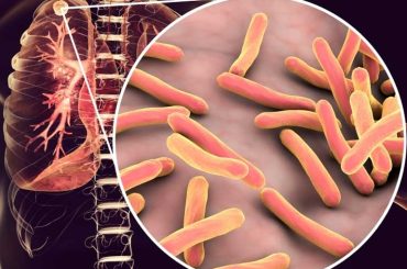 Self-Destructing Bacteria Effective for Tuberculosis Vaccines