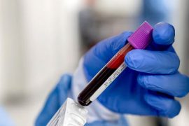 Cancer Monitoring Through Blood Tests
