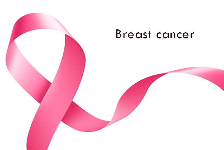 Five simple daily actions you can take to prevent breast cancer Five simple daily actions you can take to prevent breast cancer