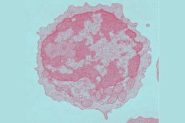 Aging impairs metabolism, which lowers CAR-T cell efficiency, study shows