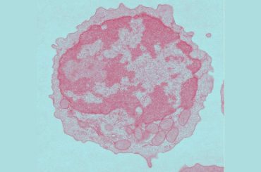 Aging impairs metabolism, which lowers CAR-T cell efficiency, study shows