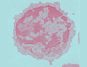 Aging impairs metabolism, which lowers CAR-T cell efficiency, study shows