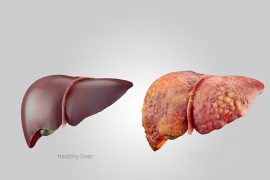 Typical symptoms could indicate a major liver issue in children, according to a doctor