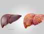 Typical symptoms could indicate a major liver issue in children, according to a doctor