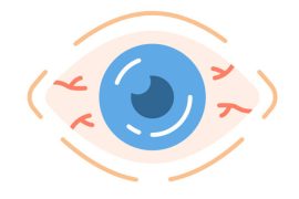 screen fatigue