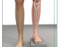Surgeon warns that skipping leg day could prevent a heart attack
