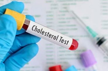 Common Kitchen Mistake May Be Secretly Raising Cholesterol: Doctor Warns