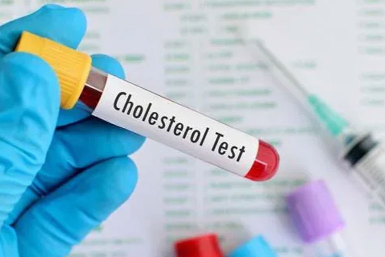 Common Kitchen Mistake May Be Secretly Raising Cholesterol: Doctor Warns Common Kitchen Mistake May Be Secretly Raising Cholesterol: Doctor Warns