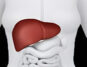 Young Adult Liver Failure Is on the Rise, Says Gastroenterologist