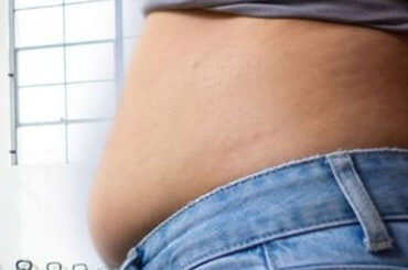 Lose Belly Fat Quickly with These 5 Tried-and-True Steps