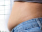 Lose Belly Fat Quickly with These 5 Tried-and-True Steps