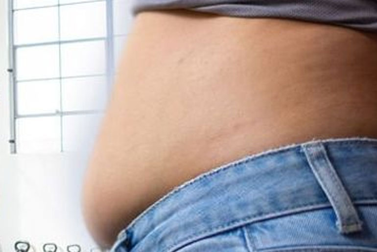 Lose Belly Fat Quickly with These 5 Tried-and-True Steps