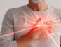 Sudden Cardiac Deaths