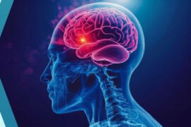 How a Stroke Affects Your Future: The Vital First Ninety Days