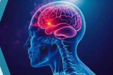 How a Stroke Affects Your Future: The Vital First Ninety Days