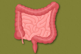 Colon Cancer