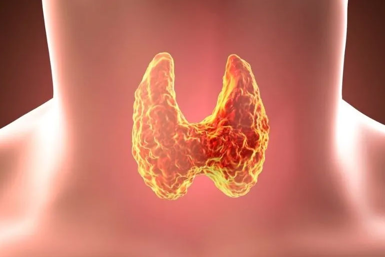 Soy to Pesticides: 10 Common Triggers That May Cause Thyroid Disturbances