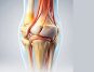 Arthritic Joint Pain