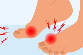 Night Foot Pain and Uric Acid