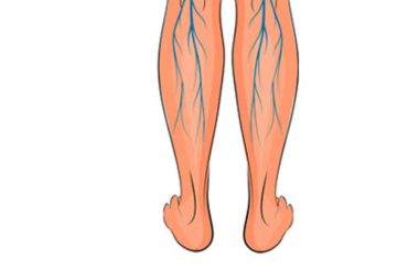 Increase Blood Flow and Reduce Varicose Veins