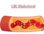 LDL Cholesterol